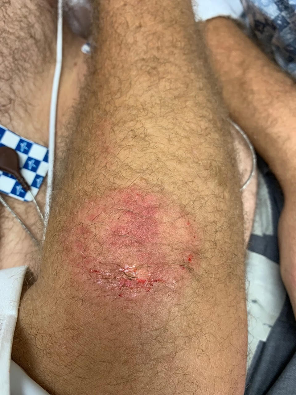 Injured trooper 2
